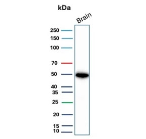 Western blot testing of human brain tissue with Glial fibrillary acidic protein antibody (clone GFAP/9426). Predicted molecular weight ~50 kDa.
