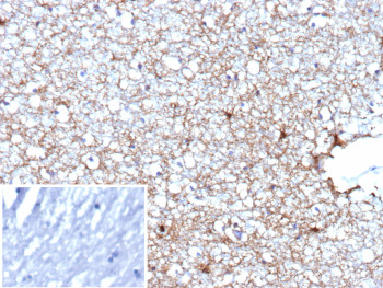 IHC staining of FFPE human brain tissue with Glial fibrillary acidic protein antibody (clone GFAP/9426). Inset: PBS used in place of primary Ab (secondary Ab negative control). HIER: boil tissue sections in pH 9 10mM Tris with 1mM EDTA for 20 min and allow to cool before testing.
