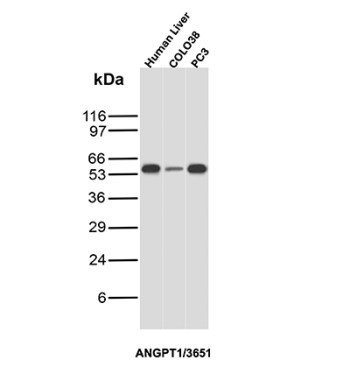 ANGPT1 Antibody Multi-Sample WB. Western blot analysis of Lane 1: human liver lysate, Lane 2: COLO38 cell lysate, and Lane 3: PC3 cell lysate using ANGPT1 Antibody clone ANGPT1/3651. A band is detected at approximately 57 kDa in all three samples, consistent with the predicted molecular weight of Angiopoietin-1 / ANGPT1. ANGPT1 is a secreted vascular growth factor that signals through the TEK/TIE2 receptor to regulate blood vessel maturation, vascular stability, and endothelial cell survival. The observed signal is consistent with the established expression of ANGPT1 in tissues and cell types involved in angiogenic and vascular regulatory pathways.