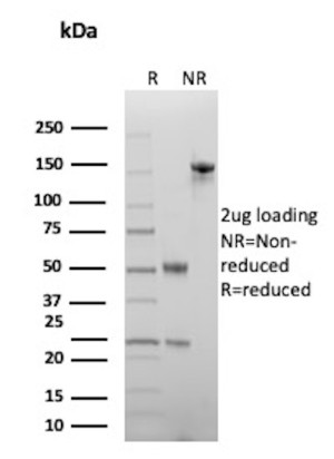 GTBP Antibody MSH6/13194R Purity Analysis by SDS-PAGE. Electrophoretic analysis of purified GTBP Antibody / G/T mismatch-binding protein / MSH6, clone MSH6/13194R, under reducing (R) and non-reducing (NR) conditions with 2 ug of antibody loaded per lane. The reduced sample shows bands at approximately 50 and 25 kDa, corresponding to the antibody heavy and light chains, while the non-reduced sample shows intact antibody at approximately 150 kDa. This analysis confirms the purity and integrity of the antibody preparation.