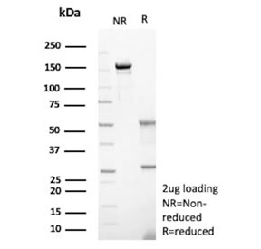 SDS-PAGE analysis of purified, BSA-free Hexokinase 1 antibody (clone HK1/9515) as confirmation of integrity and purity.