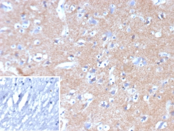 IHC staining of FFPE human brain tissue with Hexokinase 1 antibody (clone HK1/9517). Inset: PBS used in place of primary Ab (secondary Ab negative control). HIER: boil tissue sections in pH 9 10mM Tris with 1mM EDTA for 20 min and allow to cool before testing.