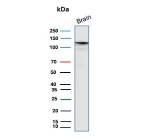 Western blot testing of human brain tissue lysate with HK1 antibody (clone HK1/9506). Predicted molecular weight ~120 kDa.