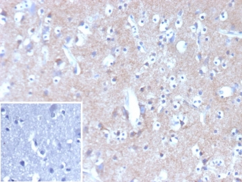 IHC staining of FFPE human brain tissue with HK1 antibody (clone HK1/9506). Inset: PBS used in place of primary Ab (secondary Ab negative control). HIER: boil tissue sections in pH 9 10mM Tris with 1mM EDTA for 20 min and allow to cool before testing.