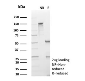SDS-PAGE analysis of purified, BSA-free HK1 antibody (clone HK1/9506) as confirmation of integrity and purity.