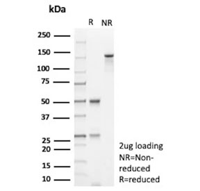 SDS-PAGE analysis of purified, BSA-free HLA-E antibody (clone HLAE/9468) as confirmation of integrity and purity.