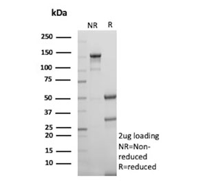 SDS-PAGE analysis of purified, BSA-free BIRC5 antibody (clone BIRC5/9071) as confirmation of integrity and purity.