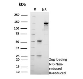 SDS-PAGE analysis of purified, BSA-free HSD17B13 antibody (clone HSD17B13/13106) as confirmation of integrity and purity.