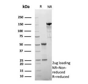 SDS-PAGE analysis of purified, BSA-free 17-beta-hydroxysteroid dehydrogenase 13 antibody (clone HSD17B13/13109) as confirmation of integrity and purity.