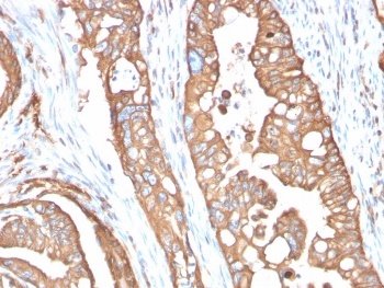 IHC staining of FFPE human small intestine tissue with Aquaporin 4 antibody (clone AQP4/3321). Inset: PBS used in place of primary Ab (secondary Ab negative control). HIER: boil tissue sections in pH 9 10mM Tris with 1mM EDTA for 20 min and allow to cool before testing.