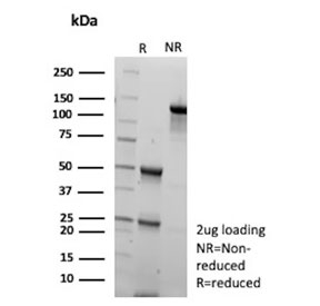 SDS-PAGE analysis of purified, BSA-free KNG1 antibody (clone KNG1/7422) as confirmation of integrity and purity.