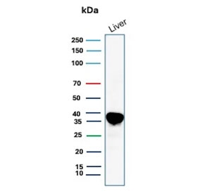 Arginase 1 Antibody for WB (clone ARG1/9446) western blot analysis of human liver lysate. Western blot detection using the mouse monoclonal Arginase 1 Antibody for WB (clone ARG1/9446) shows a strong immunoreactive band in human liver tissue lysate. Lane 1: human liver lysate. A band is detected at approximately 35 kDa, consistent with the predicted molecular weight of Arginase-1 (ARG1), a cytosolic urea cycle enzyme highly enriched in hepatocytes and responsible for the conversion of L-arginine to urea and ornithine in hepatic nitrogen metabolism.