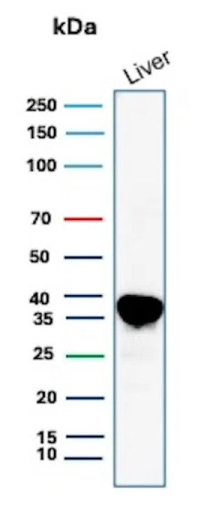 Arginase 1 Antibody for WB (clone ARG1/9446). Western blot analysis of human liver lysate. Western blot detection using the mouse monoclonal Arginase 1 Antibody for WB (clone ARG1/9446) shows a strong immunoreactive band in human liver tissue lysate. Lane 1: human liver lysate. A band is detected at approximately 35 kDa, consistent with the predicted molecular weight of Arginase-1 (ARG1), a cytosolic urea cycle enzyme highly enriched in hepatocytes and responsible for the conversion of L-arginine to urea and ornithine in hepatic nitrogen metabolism.