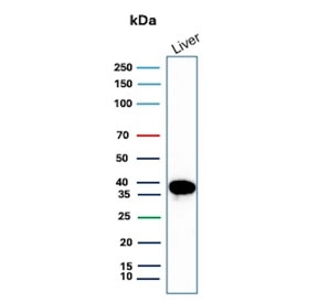 Liver Arginase Antibody (clone ARG1/9447) western blot analysis of human liver lysate. Lane 1: human liver tissue lysate. A band is detected at approximately 35 kDa, consistent with the predicted molecular weight of Arginase-1 (ARG1), a cytosolic urea cycle enzyme highly enriched in hepatocytes and responsible for the conversion of L-arginine to urea and ornithine in hepatic nitrogen metabolism.