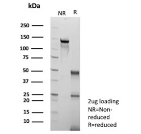 SDS-PAGE analysis of purified, BSA-free Liver Arginase antibody (clone ARG1/9447) as confirmation of integrity and purity.