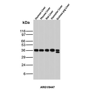 Liver Arginase Antibody by WB in Multiple Species. Western blot analysis of human, mouse, rat, hamster, and guinea pig liver tissue lysates using Liver Arginase Antibody (ARG1/9447). Lane 1: human liver; lane 2: mouse liver; lane 3: rat liver; lane 4: hamster liver; lane 5: guinea pig liver. A prominent immunoreactive band is detected at approximately 35-38 kDa in all five species, consistent with the predicted molecular weight of ARG1 (~35 kDa). The Arginase-1 ARG1 Antibody demonstrates strong cross-species reactivity, with comparable band intensities across the liver samples. An additional band near 32 kDa is visible in guinea pig liver lysate.