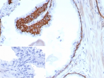 CD13 Antibody Human Prostate IHC. Immunohistochemistry staining of FFPE human prostate tissue with CK13/Cytokeratin 13 antibody (clone KRT13/8577R). Inset: PBS used in place of primary Ab (secondary Ab negative control). HIER: boil tissue sections in pH 9 10mM Tris with 1mM EDTA for 20 min and allow to cool before testing.