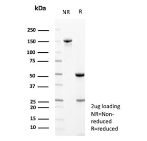 SDS-PAGE analysis of purified, BSA-free Neural cell adhesion molecule L1 antibody (clone L1CAM/13053R) as confirmation of integrity and purity.