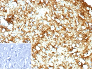 Immunohistochemistry analysis of recombinant MBP / Myelin basic protein antibody (clone rMBP/9431) in human brain tissue. Formalin-fixed, paraffin-embedded human brain tissue was stained using recombinant MBP antibody (clone rMBP/9431). Heat-induced epitope retrieval was performed by boiling tissue sections in 10mM Tris with 1mM EDTA, pH 9.0, for 20 minutes followed by cooling prior to antibody incubation. Strong cytoplasmic and fiber-like staining is observed throughout white matter regions, highlighting myelinated axonal tracts, while neuronal cell bodies demonstrate minimal staining. The inset image represents a secondary-only negative control using PBS in place of primary antibody and shows absence of specific immunoreactivity.