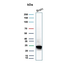Western blot testing of human brain tissue lysate with recombinant MBP antibody (clone rMBP/9431). Predicted molecular weight: ~22 kDa, ~33 kDa (two isoforms).