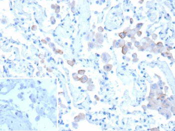 Mannose Receptor Antibody Human Lung IHC. Immunohistochemical staining of FFPE human lung tissue using Mannose Receptor antibody (clone MRC1/9457) demonstrates distinct cytoplasmic and membranous HRP-DAB brown staining within scattered immune cell populations distributed throughout the pulmonary tissue. The staining pattern is consistent with expression of the Mannose Receptor (MRC1/CD206), a C-type lectin receptor involved in carbohydrate recognition, receptor-mediated endocytosis, antigen processing, and macrophage-mediated immune regulation. Positive immunoreactivity is observed in cells morphologically consistent with alveolar macrophages and other antigen-presenting cell populations that contribute to pulmonary immune surveillance and maintenance of respiratory tissue homeostasis. Inset: PBS was used in place of the primary antibody as a negative control. HIER: boil tissue sections in pH 9, 10mM Tris with 1mM EDTA for 20 min and allow to cool before testing.
