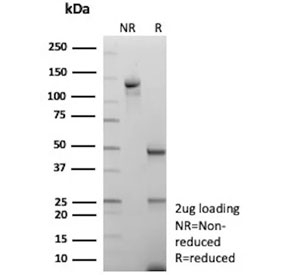 SDS-PAGE analysis of purified, BSA-free Mannose Receptor antibody (clone MRC1/9457) as confirmation of integrity and purity.