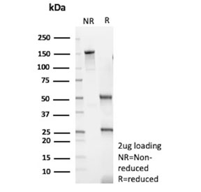 SDS-PAGE analysis of purified, BSA-free recombinant Myosin 7 antibody (clone MYH7/13050R) as confirmation of integrity and purity.