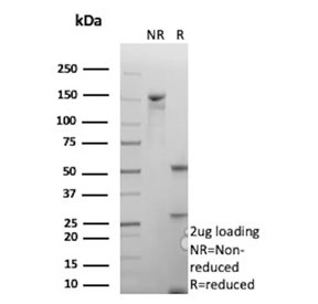 SDS-PAGE analysis of purified, BSA-free ATM antibody (clone ATM/9472) as confirmation of integrity and purity.