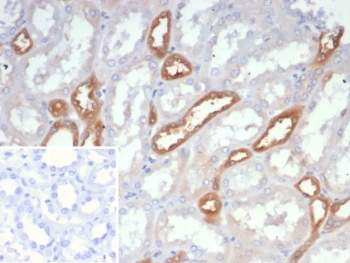 IHC analysis of NDPK-B / NME2 antibody in human kidney tissue. Formalin-fixed, paraffin-embedded human kidney shows cytoplasmic HRP-DAB brown chromogenic staining predominantly in renal tubular epithelial cells, while glomerular structures exhibit minimal staining. Clone NME2/6436 demonstrates specific signal following heat-induced epitope retrieval in pH 9 10mM Tris with 1mM EDTA for 20 min. The inset negative control using PBS instead of primary antibody shows no specific staining.