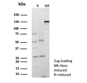 SDS-PAGE analysis of purified, BSA-free PD-Ibeta antibody (clone ENPP3/9891) as confirmation of integrity and purity.