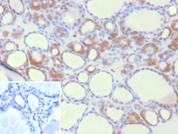 HEG1 Antibody Thyroid IHC. Immunohistochemical analysis of Heart development protein with EGF-like domains 1 (HEG1) in formalin-fixed, paraffin-embedded human thyroid tissue using HEG1 antibody clone HEG1/9445. Distinct membranous and cytoplasmic staining is observed in thyroid follicular epithelial cells, outlining follicular structures, with additional staining in vascular-associated endothelial cells. The staining pattern is consistent with HEG1 localization at cell-cell interfaces and supports its role in tissue organization and endothelial function. Inset: PBS used in place of primary antibody serves as a negative control for secondary antibody binding. Required HIER: boil tissue sections in pH 9 10mM Tris with 1mM EDTA for 20 min and allow to cool before testing.
