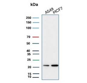 Western blot testing of human A549 and MCF7 cell lysate with recombinant Bax antibody (clone rBAX/962). Predicted molecular weight ~21 kDa.