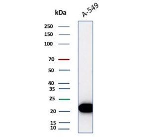 Western blot testing of human A549 cell lysate with recombinant Bax antibody (clone rBAX/962). Predicted molecular weight ~21 kDa.