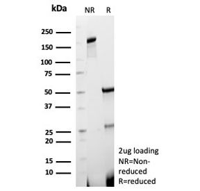 SDS-PAGE analysis of purified, BSA-free ACE2 Antibody Clone ACE2/7202 as confirmation of integrity and purity.