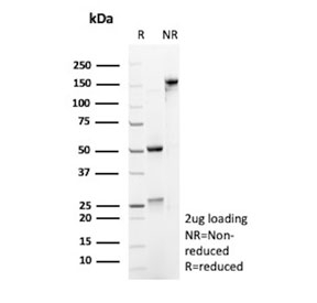 SDS-PAGE analysis of purified, BSA-free S100A4 antibody (clone S100A4/6797) as confirmation of integrity and purity.