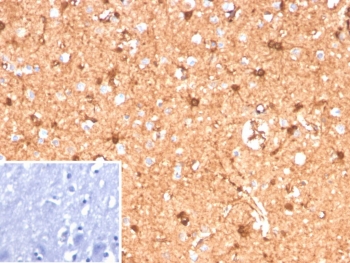 Immunohistochemistry analysis of S100B / S100 calcium-binding protein B antibody (clone S100B/12587R) in human brain tissue. FFPE human brain demonstrates diffuse cytoplasmic and nuclear HRP-DAB brown staining in glial cells, consistent with S100B expression. Staining highlights astrocyte-like cells with branching morphology distributed throughout the parenchyma, while neuronal cell bodies show comparatively weaker signal. Nuclei are counterstained blue. The inset image represents a secondary antibody negative control in which PBS was used in place of the primary antibody and shows absence of specific staining. Heat induced epitope retrieval was performed by boiling tissue sections in 10 mM Tris with 1 mM EDTA, pH 9.0, for 20 minutes followed by cooling prior to immunostaining.