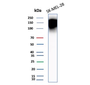 Western blot analysis of CEACAM1 antibody in human SK-MEL-28 cell lysate. A strong high molecular weight band and broad signal are observed well above the predicted molecular weight of 58 kDa. In some experimental settings, a lighter band may be detected near the predicted molecular weight, representing less glycosylated forms of CEACAM1. The predicted molecular weight of CEACAM1, also known as BGP-1, is approximately 58 kDa based on amino acid sequence; however, CEACAM1 is a heavily N-glycosylated type I membrane glycoprotein. Extensive N-linked glycosylation, heterogeneous glycoform distribution, and potential dimerization can result in markedly slower SDS-PAGE migration and apparent molecular weights substantially higher than the sequence-predicted size. The prominent high molecular weight signal observed here is therefore consistent with glycosylated CEACAM1 species in melanoma-derived cells.