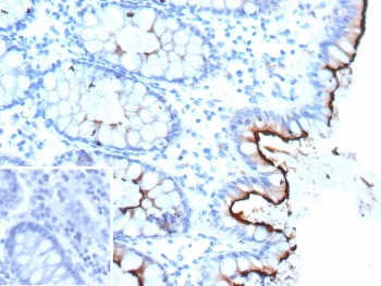 IHC staining of FFPE human colon tissue with CD66a antibody (clone CEACAM1/12661). Inset: PBS used in place of primary Ab (secondary Ab negative control). HIER: boil tissue sections in pH 9 10mM Tris with 1mM EDTA for 20 min and allow to cool before testing.