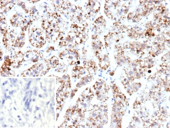 IHC staining of FFPE human adrenal gland tissue with mtTFA antibody (clone TFAM/9713). Inset: PBS used in place of primary Ab (secondary Ab negative control). HIER: boil tissue sections in pH 9 10mM Tris with 1mM EDTA for 20 min and allow to cool before testing.