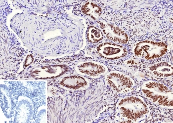 TLE1 Antibody / Groucho Family Transcriptional Corepressor immunohistochemistry analysis of human endometrium tissue using clone rTLE1/13032. Formalin-fixed paraffin-embedded human endometrium tissue shows nuclear staining in glandular epithelial cells consistent with expression of Transducin-Like Enhancer Protein 1, a member of the Groucho family transcriptional corepressor proteins that regulate gene expression through transcriptional repression complexes. Nuclear localization reflects the role of TLE1 as a Groucho family transcriptional corepressor functioning within chromatin-associated regulatory complexes controlling developmental gene expression programs. Stromal cells show weaker staining while epithelial structures demonstrate more prominent nuclear signal. The inset panel shows PBS used in place of the primary antibody as a secondary antibody negative control. Heat-induced epitope retrieval was performed by boiling tissue sections in pH 9 Tris-EDTA buffer for 20 minutes followed by cooling prior to antibody staining.