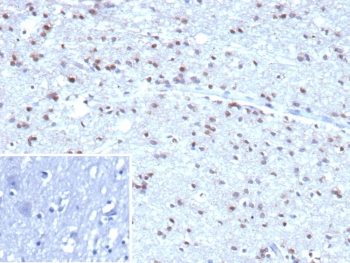 Immunohistochemistry analysis of Ubiquitin antibody in human brain tissue (clone rUBB/9476). FFPE human brain sections demonstrate scattered HRP-DAB brown staining within neuronal cell bodies and glial cells, with predominantly cytoplasmic signal and occasional nuclear staining consistent with ubiquitin localization in both cytoplasmic and nuclear protein pools. The staining pattern reflects the widespread distribution of ubiquitinated proteins in neural tissue. Background staining is minimal, and surrounding neuropil shows light diffuse signal. The inset image shows the PBS secondary-only negative control, confirming absence of specific staining in the control section. Heat induced epitope retrieval was performed by boiling tissue sections in pH 9 10mM Tris with 1mM EDTA for 20 minutes followed by cooling prior to primary antibody incubation.