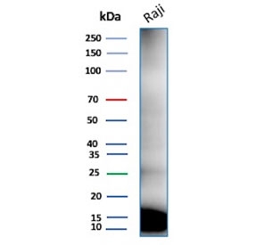 Western blot testing of human Raji tissue lysate with Ubiquitin antibody (clone rUBB/9476).