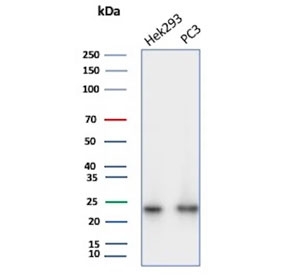 Western blot testing of human HEK293 and PC-3 cell lysate with PGP9.5 antibody (clone UCHL1/8153). Predicted molecular weight ~25 kDa.