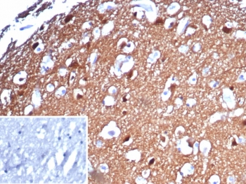 IHC staining of FFPE human brain tissue with PGP9.5 antibody (clone UCHL1/8153). Inset: PBS used in place of primary Ab (secondary Ab negative control). HIER: boil tissue sections in pH 9 10mM Tris with 1mM EDTA for 20 min and allow to cool before testing.