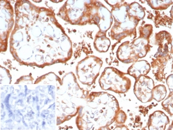 IHC staining of FFPE human placenta tissue with VEGFA antibody (clone VEGF/9366). Inset: PBS used in place of primary Ab (secondary Ab negative control). HIER: boil tissue sections in pH 9 10mM Tris with 1mM EDTA for 20 min and allow to cool before testing.