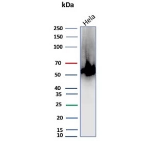 Western blot testing of human HeLa cell lysate with recombinant CA9 antibody (clone rCA9/9937). Predicted molecular weight: 50-55 kDa but may be observed at higher molecular weights due to glycosylation.