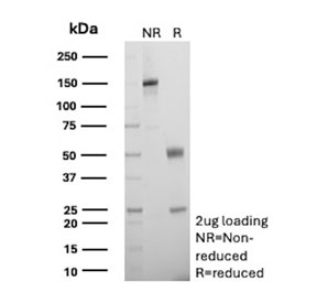 SDS-PAGE analysis of purified, BSA-free recombinant CA9 antibody (clone rCA9/9937) as confirmation of integrity and purity.