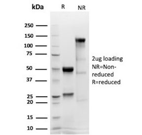 SDS-PAGE analysis of purified, BSA-free recombinant Calretinin antibody (clone CALB2/4688R) as confirmation of integrity and purity.