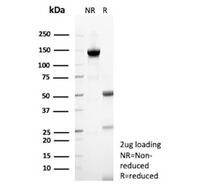 SDS-PAGE analysis of purified, BSA-free TFPI2 antibody (clone TFPI2/13025) as confirmation of integrity and purity.