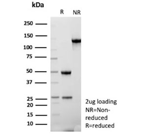 SDS-PAGE analysis of purified, BSA-free ARID1A antibody (clone ARID1A/7736) as confirmation of integrity and purity.